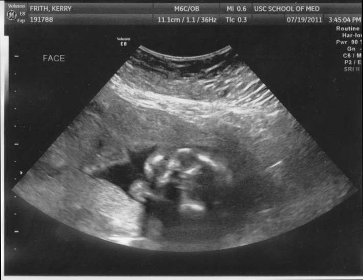 july19peanut1