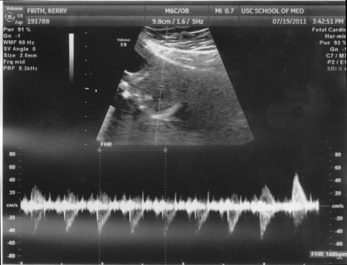 july19peanut2