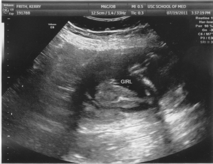 july19peanut3
