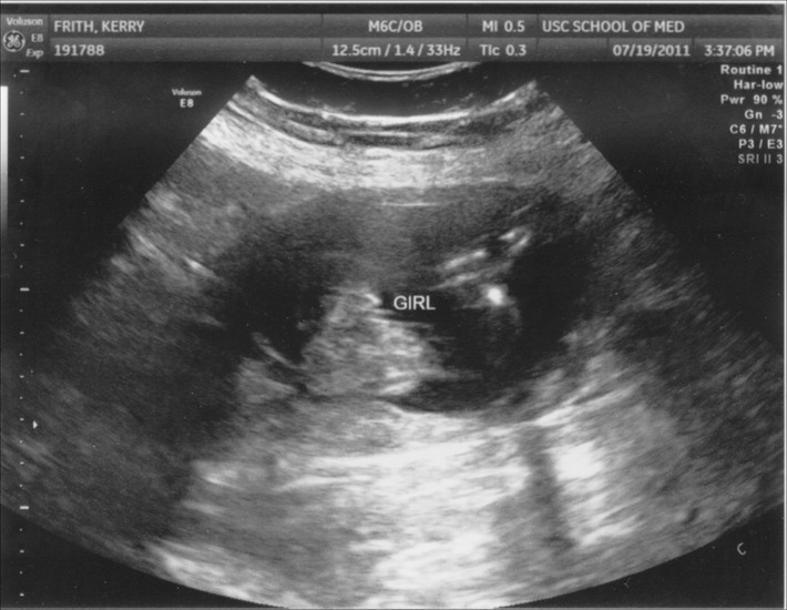 july19peanut4