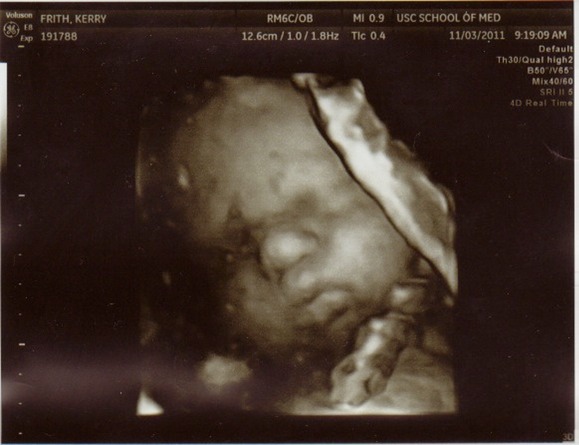 peanut3nov11 2